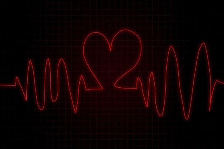 tecnologias-para-cuidar-corazon Electrocardiograma. Tecnología para cuidar el corazón.